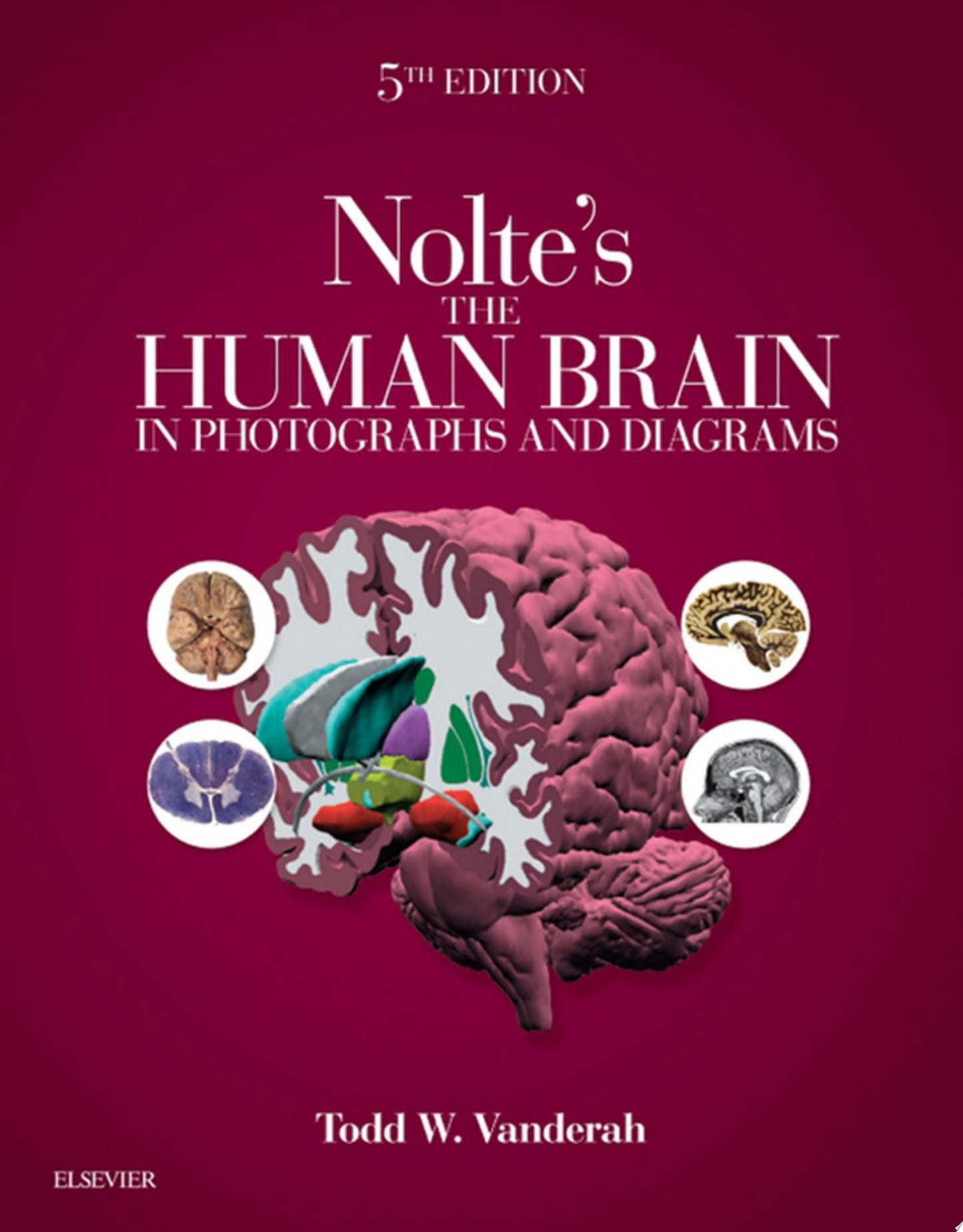 Nolte’s The Human Brain in Photographs and Diagrams, 5th edition