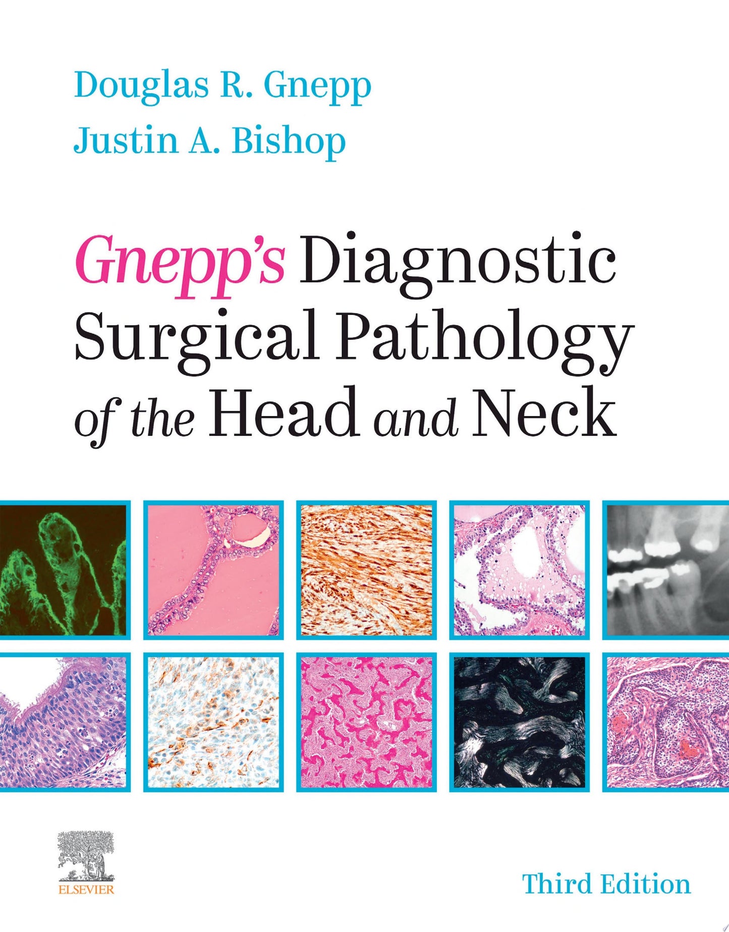 Surgical Pathology of the Head and Neck: Volume 1, 3rd edition