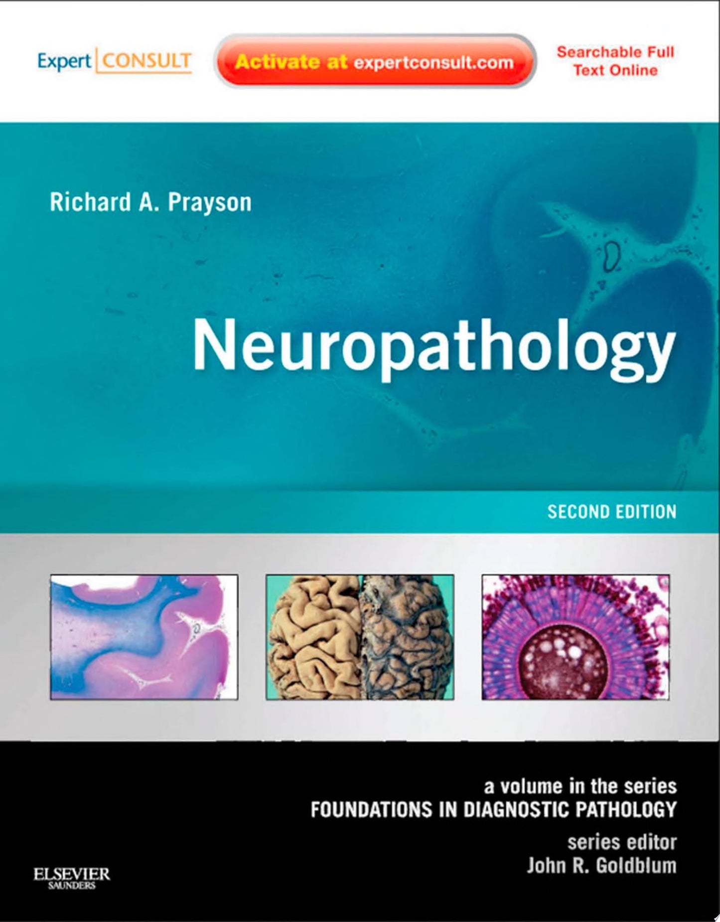 Neuropathology: A Volume in the Foundations in Diagnostic Pathology Series, Expert Consult – Online and Print, 2nd