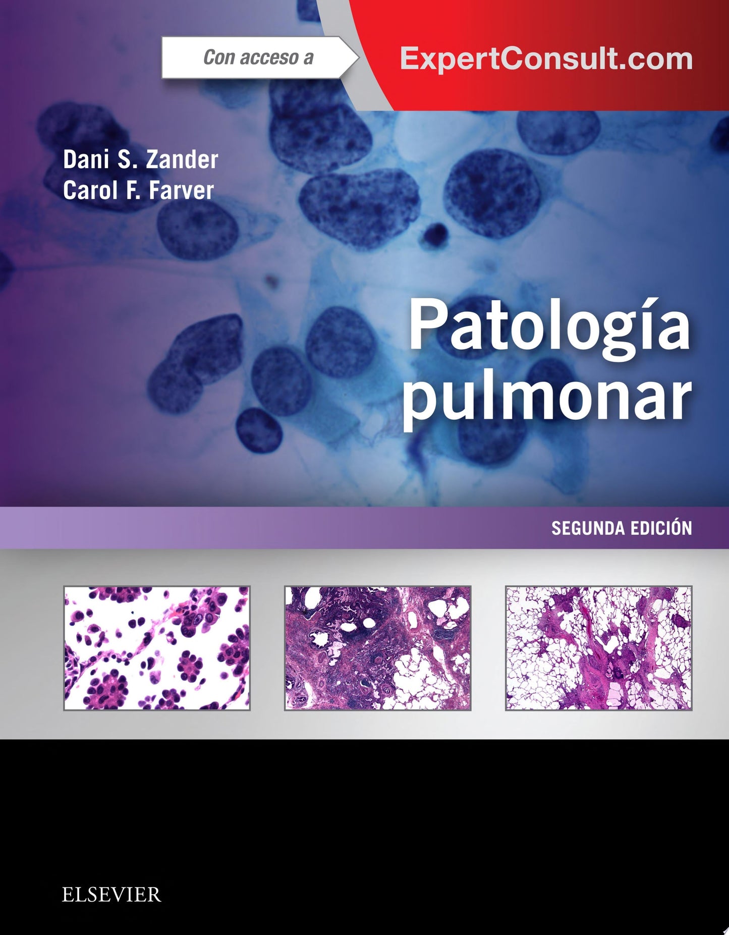 Patología pulmonar + ExpertConsult