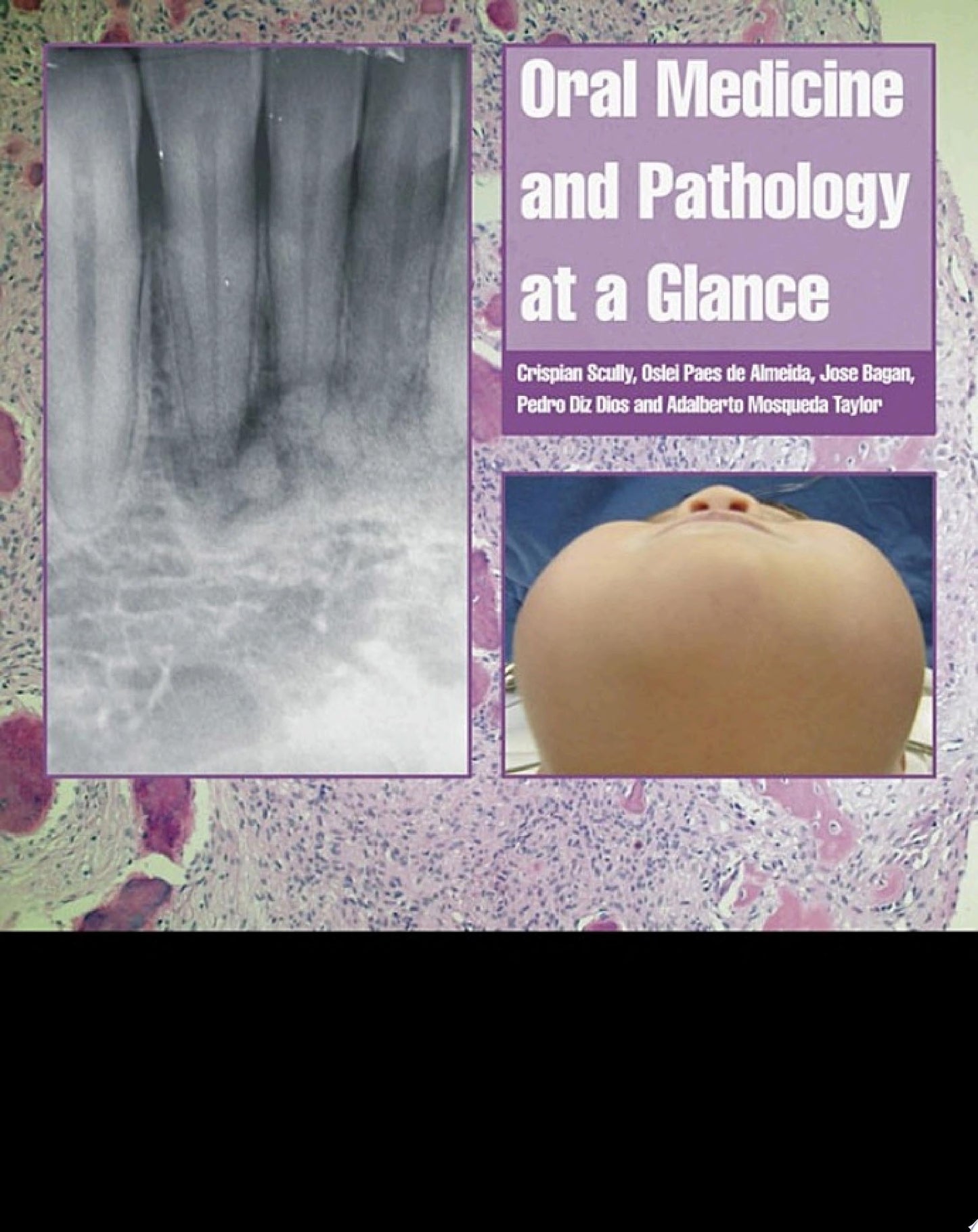 Liver Pathology, An Issue of Surgical Pathology Clinics, 1e