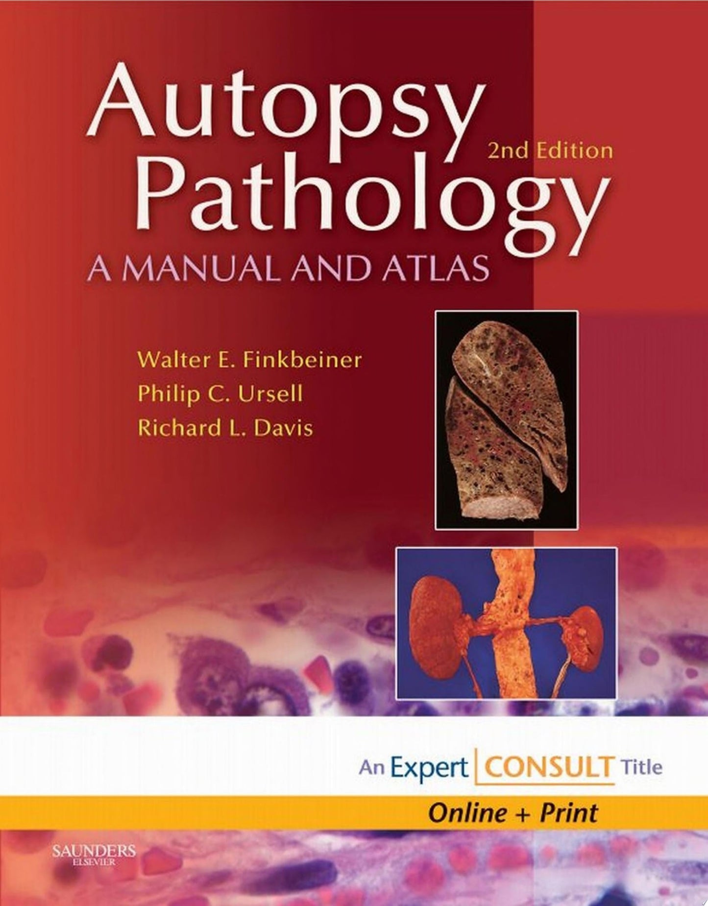 Autopsy Pathology: A Manual and Atlas, 2nd Edition