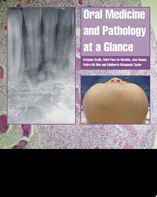 Oral Medicine and Pathology at a Glance, 2nd Edition